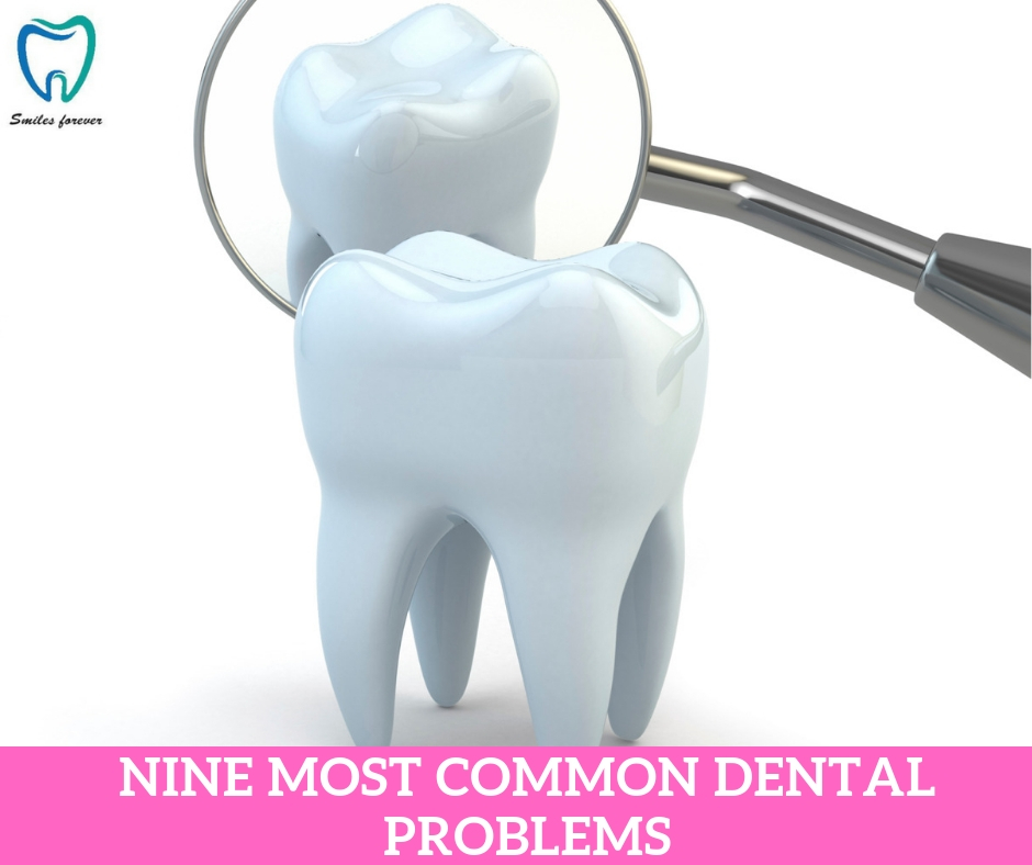 NINE MOST COMMON DENTAL PROBLEMS | Best Dental Hospital in Bangalore