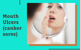 Canker Sores Treatment | Mouth Ulcer Treatment in Bellandur | Bangalore
