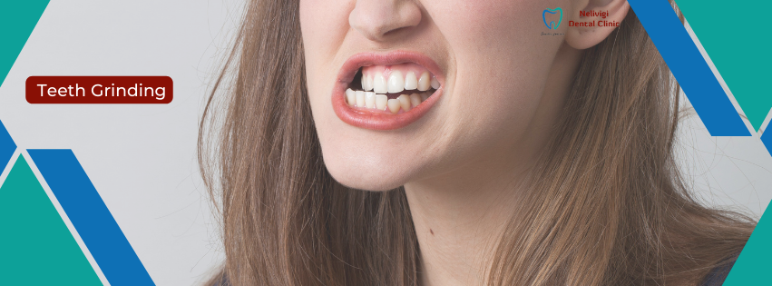 Dental Clinics Near Me | Teeth Grinding | Nelivigi Dental Clinic