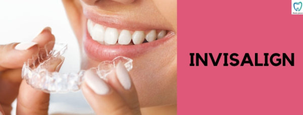 Invisalign | Best Dental Clinic for Invisalign in Bellandur