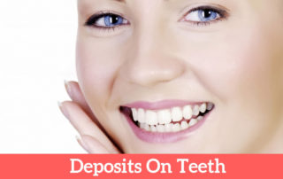 Deposits on teeth | Dentistry In Bellandur
