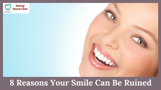 8 Reasons Your Smile Can Be Ruined | Top 10 Dental Clinics in Bellandur