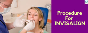 Procedure For Invisalign | Best Dental Clinic for Invisalign in Bellandur