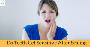 Do teeth get sensitive after scaling | Dentistry In Bellandur