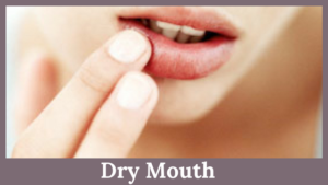 Dry Mouth | Top 10 Dental Clinics in Bellandur