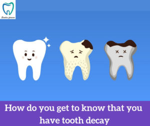 Tooth Decay | Dental Caries Treatment in Bellandur