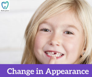 Change in Appearance | Best Dental Treatment in Bellandur