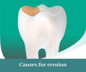 Causes for erosion | Best Dental Care Clinic in Bangalore 