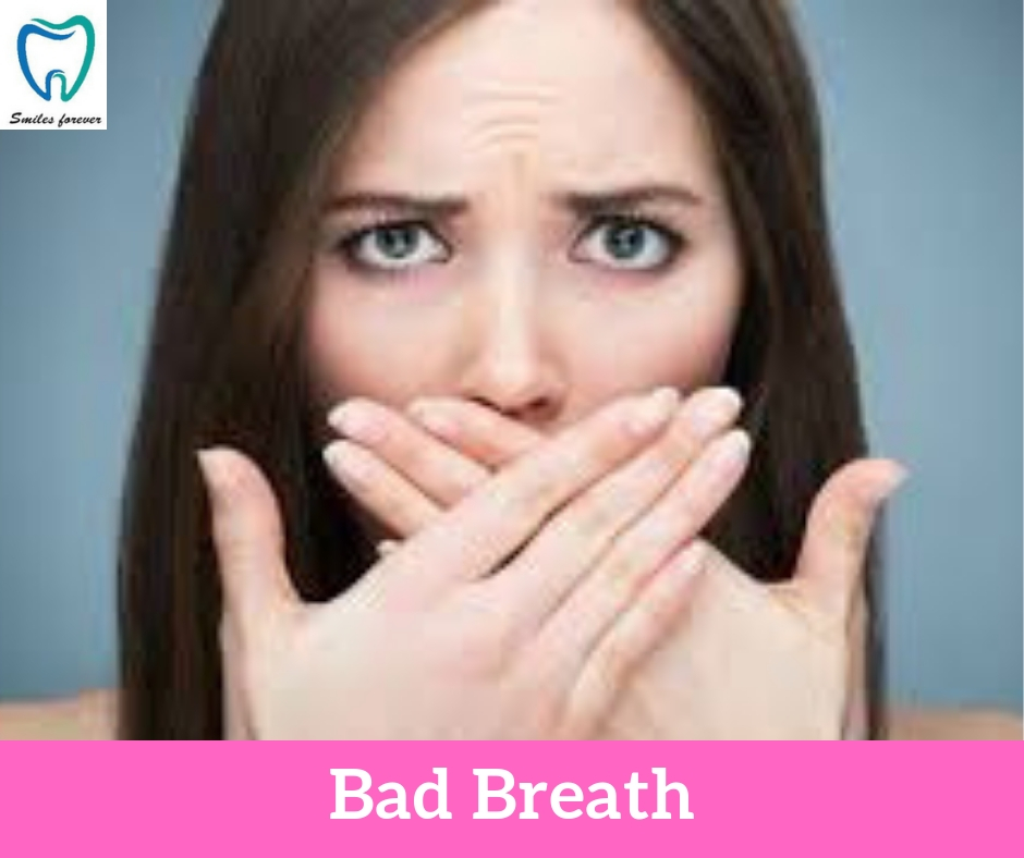 Bad Breath | Best Dental Hospital in Bangalore