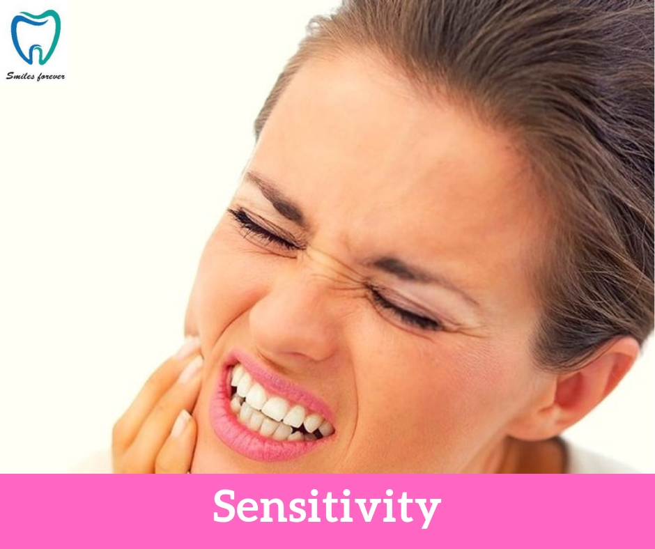 Sensitivity | Best Dental Hospital in Bangalore