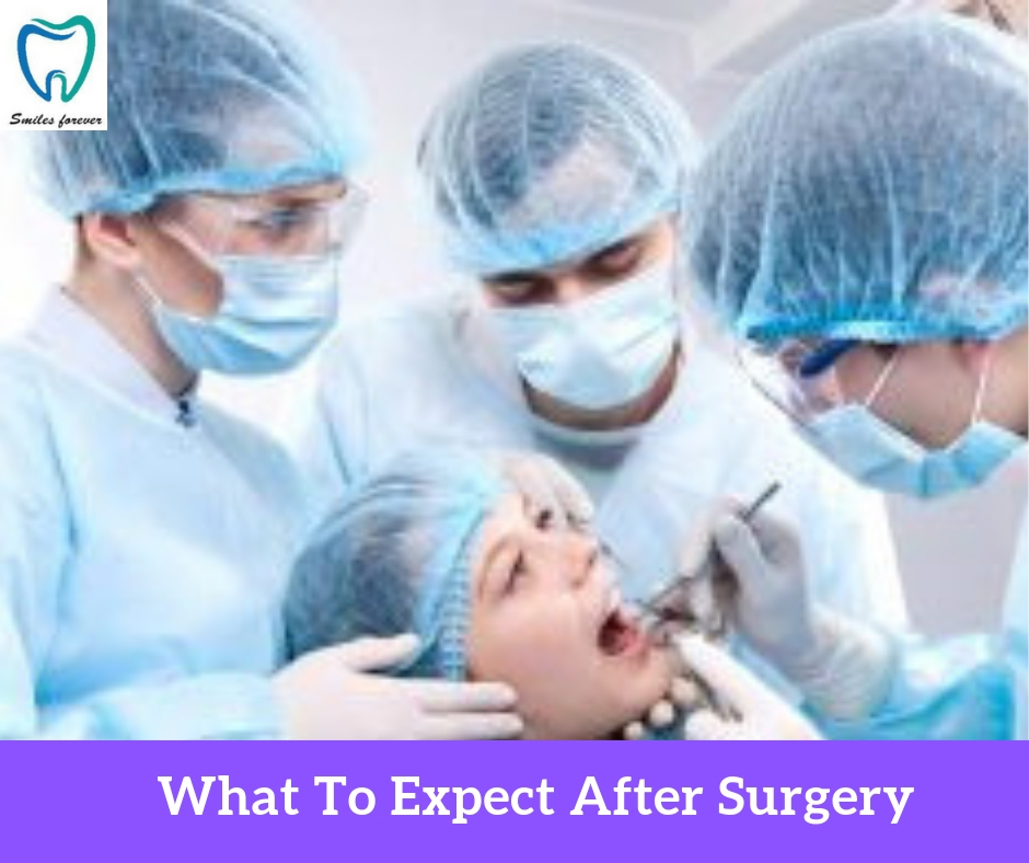 What to Expect After Surgery | Best Wisdom Tooth Extraction in Bangalore 