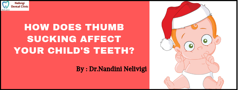 Thumb Sucking | Best Orthodontist in Bellandur 