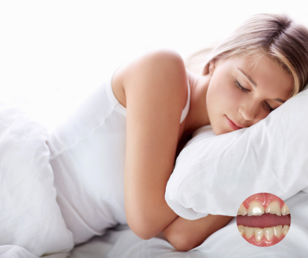 Bruxism or Night grinding