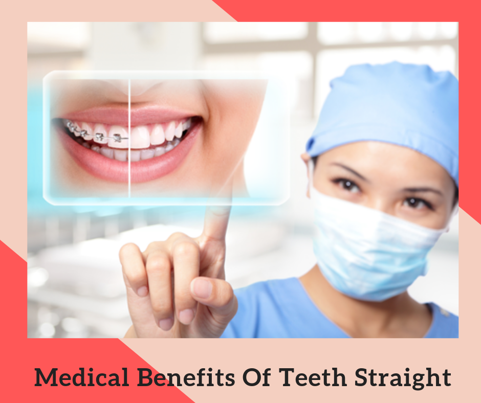 Medical Benefits Of Teeth Straight