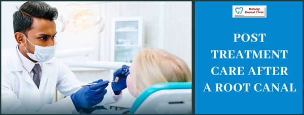 Post Treatment Care After a Root Canal | Top Root Canal Treatment in Bangalore